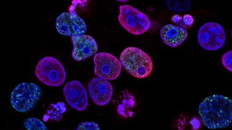 Cell Division Mitosis Simulation - Interphase vs Prophase Comparison